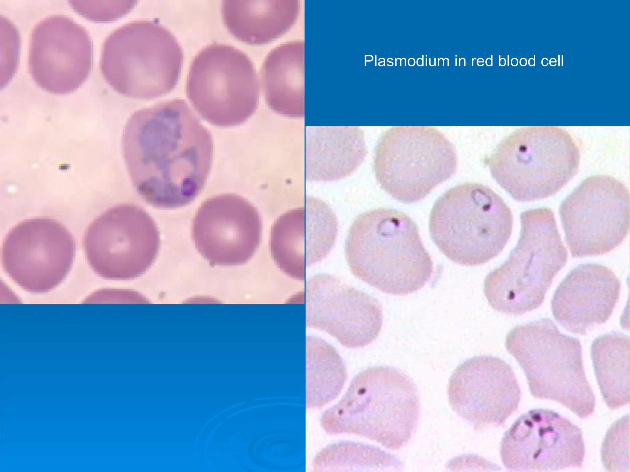 Plasmodium in red blood cell
 