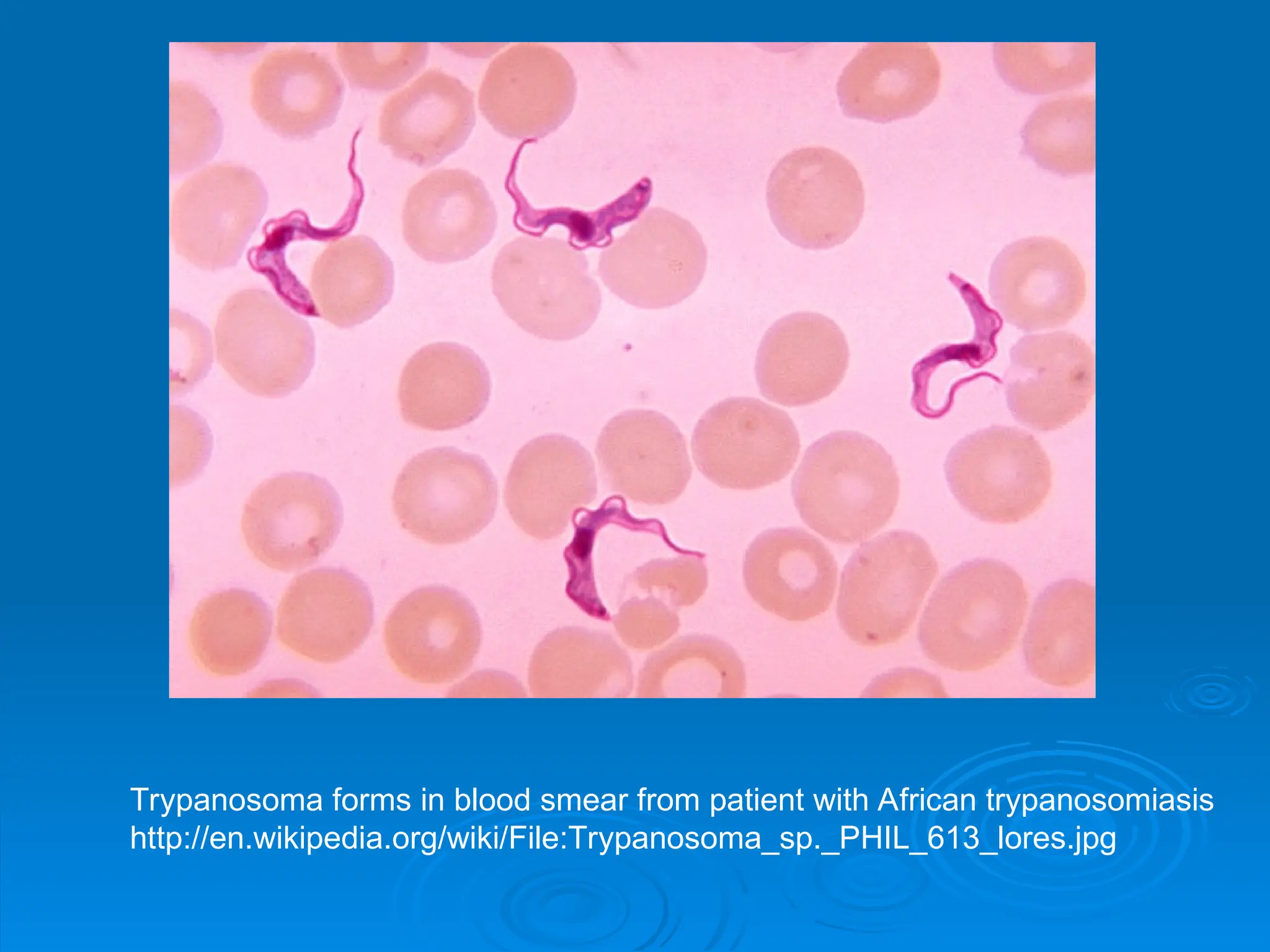 Trypanosoma forms in blood smear from patient with African trypanosomiasis
http://en.wikipedia.org/wiki/File:Trypanosoma_sp._PHIL_613_lores.jpg
 