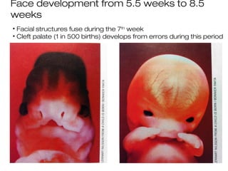 Face development from 5.5 weeks to 8.5
weeks
• Facial structures fuse during the 7th week
• Cleft palate (1 in 500 births) develops from errors during this period
 
