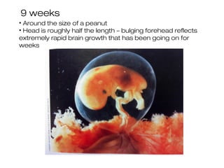 9 weeks
• Around the size of a peanut
• Head is roughly half the length – bulging forehead reflects
extremely rapid brain growth that has been going on for
weeks
 
