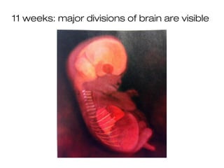 11 weeks: major divisions of brain are visible
 