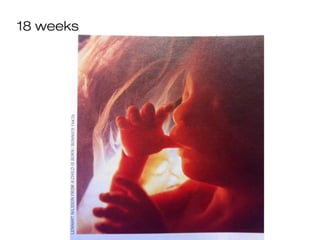 18 weeks
 