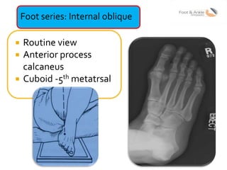 Lecture 3 shah radiology in foot and ankle | PPTX
