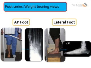 Lecture 3 shah radiology in foot and ankle | PPTX