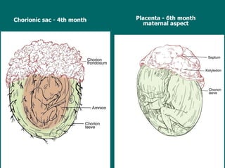 Chorionic sac - 4th month Placenta - 6th month maternal aspect 