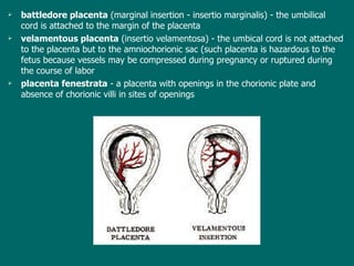 b attledore placenta  (marginal insertion - insertio marginalis) - the umbilical cord is attached to the margin of the placenta v elamentous placenta  (insertio velamentosa) - the umbical cord is not attached to the placenta but to the amniochorionic sac (such placenta is hazardous to the fetus because vessels may be compressed during pregnancy or ruptured during the course of  labor p lacenta fenestrata  - a placenta with openings in the chorionic plate and absence of chorionic villi in sites of openings 