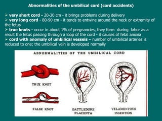 Abnormalities of the umbilical cord (cord accidents) v ery short cord -  20-30 cm - it brings problems during delivery v ery long cord  - 80-90 cm - it tends to entwine around the neck or extremity of the fetus true knots -  occur in about 1% of pregnancies, they form  during  labor as a result the fetus passing through a loop of the cord - it causes of fetal anoxia c ord with anomaly of umbilical vessels  – number of umbilical arteries is reduced to one; the umbilical vein is developed normally 