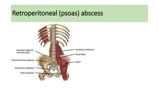 Retroperitoneal (psoas) abscess
 