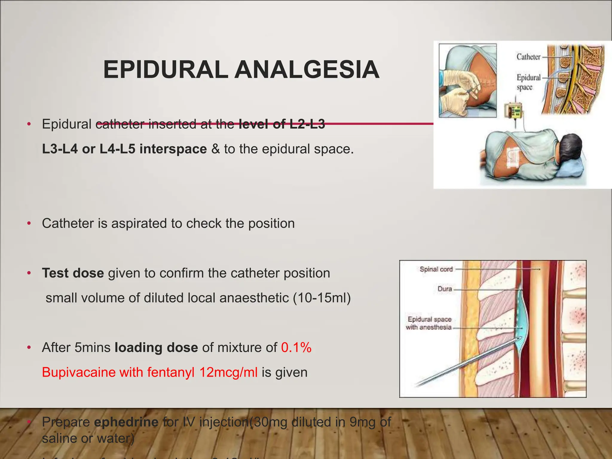 EPIDURAL ANALGESIA
• Epidural catheter inserted at the level of L2-L3
L3-L4 or L4-L5 interspace & to the epidural space.
• Catheter is aspirated to check the position
• Test dose given to confirm the catheter position
small volume of diluted local anaesthetic (10-15ml)
• After 5mins loading dose of mixture of 0.1%
Bupivacaine with fentanyl 12mcg/ml is given
• Prepare ephedrine for IV injection(30mg diluted in 9mg of
saline or water)
 