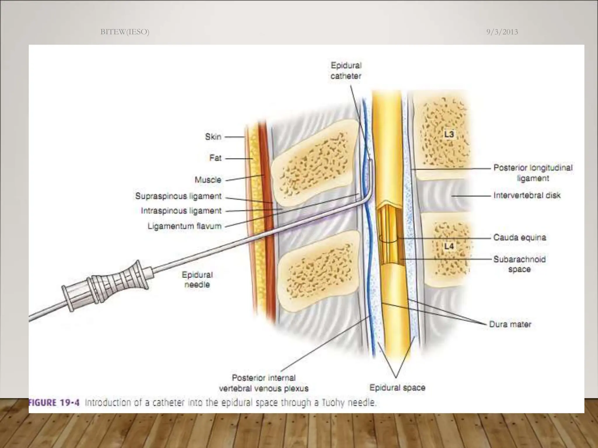 9/3/2013
BITEW(IESO)
41
 