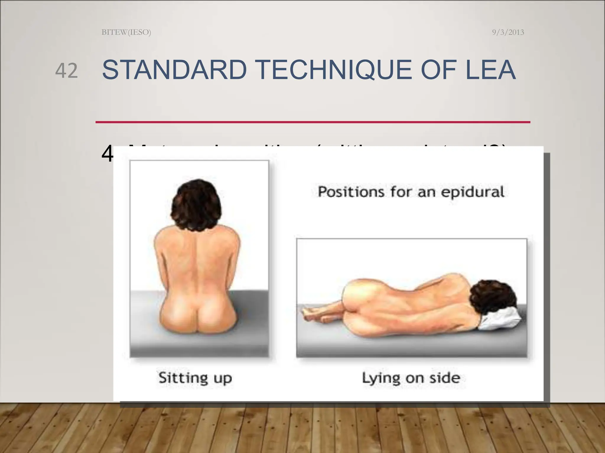 STANDARD TECHNIQUE OF LEA
4. Maternal position ( sitting or lateral?)
9/3/2013
BITEW(IESO)
42
 