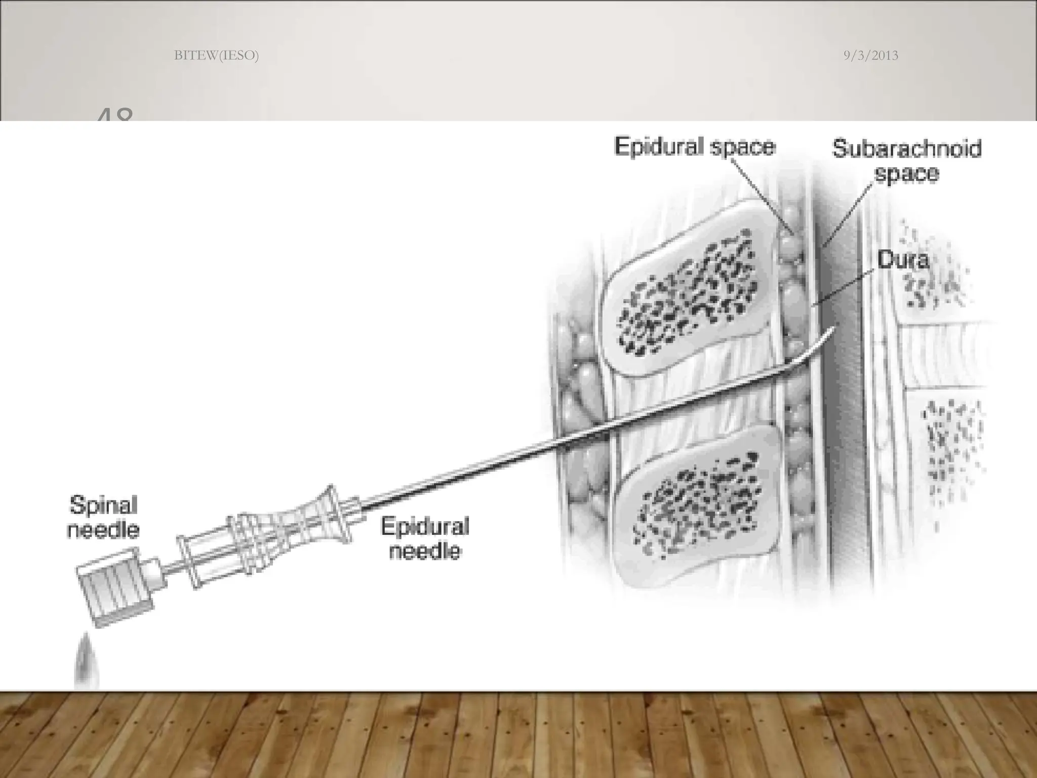 9/3/2013
BITEW(IESO)
48
 