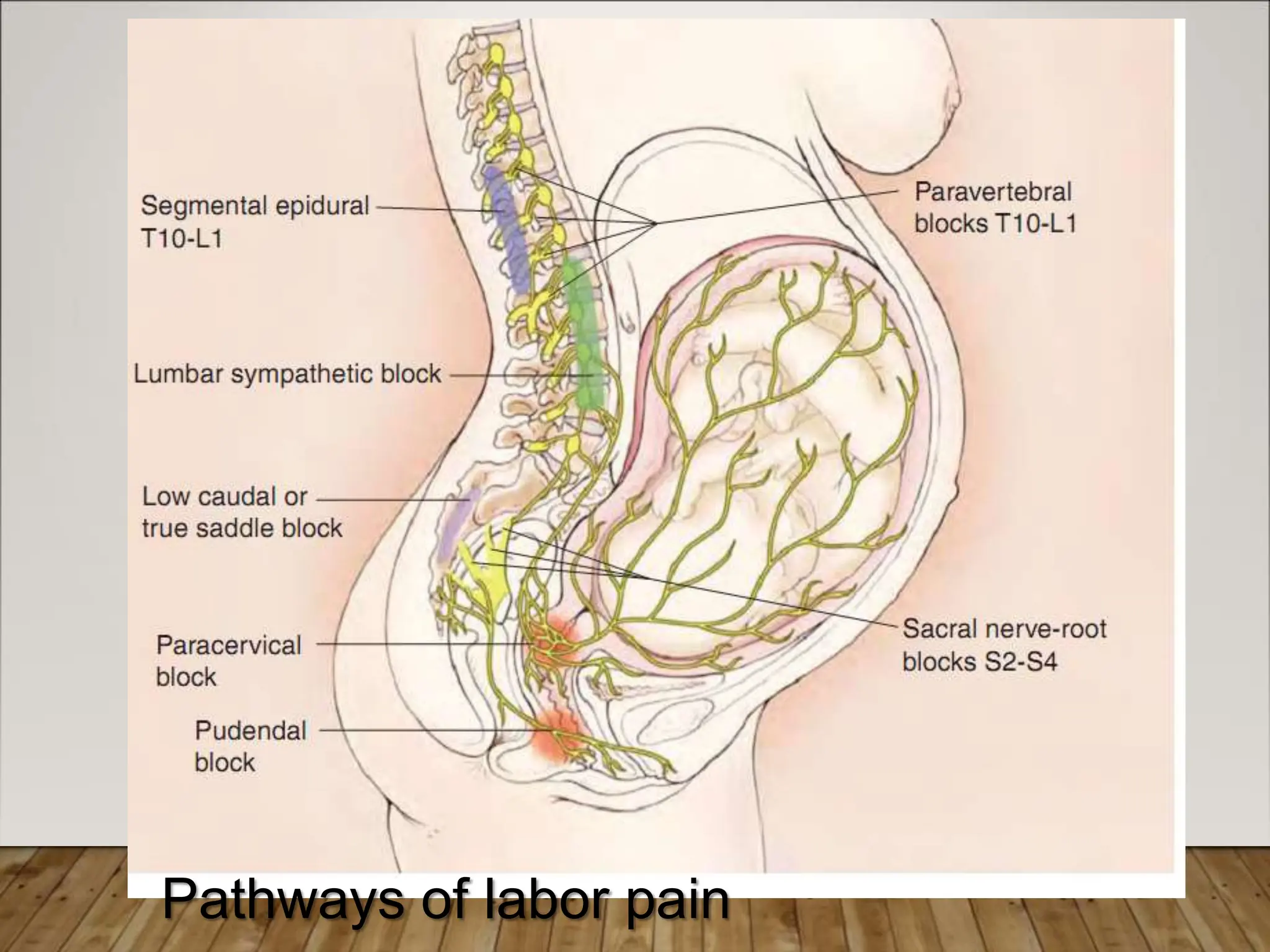 9/3/2013
BITEW(IESO)
9
Pathways of labor pain
 