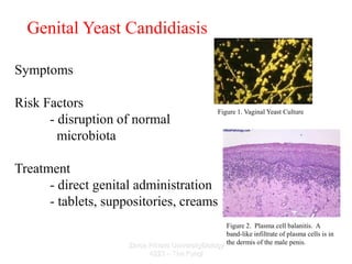 Zarqa Private UniversityBiology
4223 – The Fungi
Genital Yeast Candidiasis
Symptoms
Risk Factors
- disruption of normal
mi...