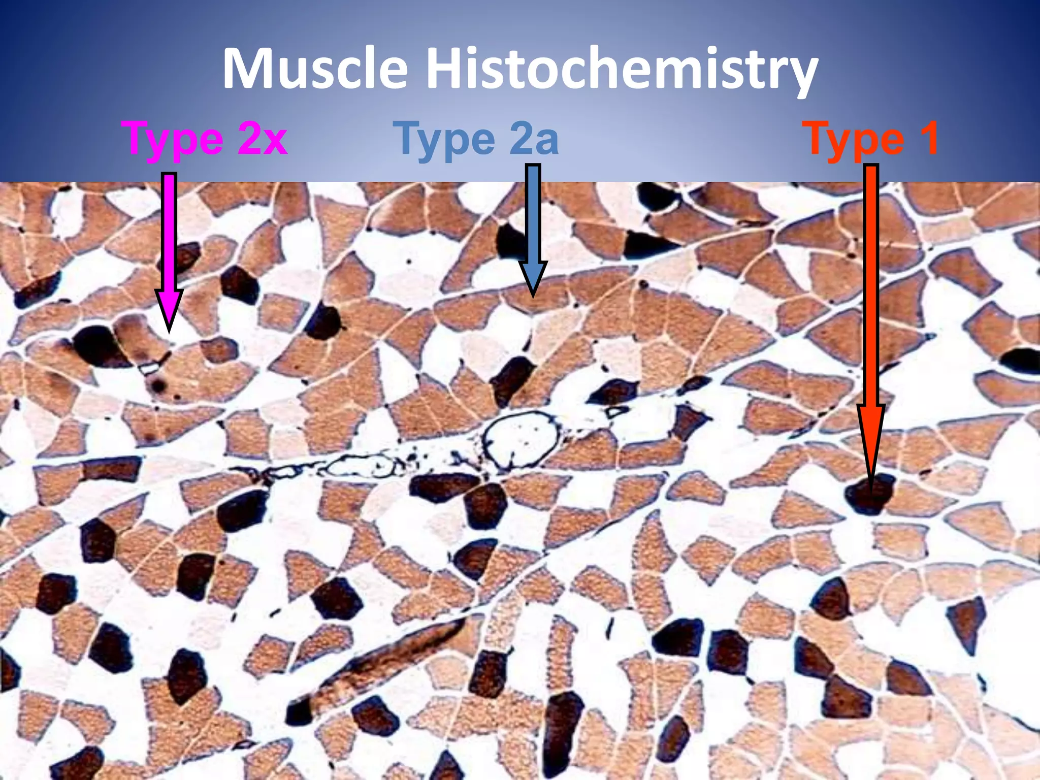 Muscle Histochemistry
Type 2a Type 1Type 2x
 