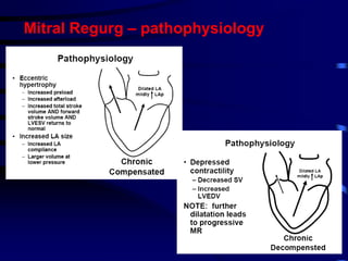 Lecture 4-Valvular Heart Diseases (1).ppt