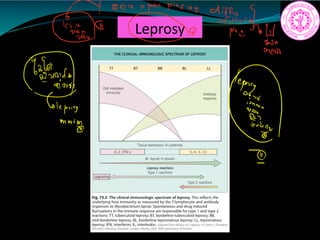 Leprosy
61 or t the
differentiation
must2
 