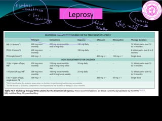Leprosy
ii
Coin anÉ
 