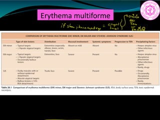 Erythema multiforme
ifsteai.hunanarne feiifh
EE
c. e
 