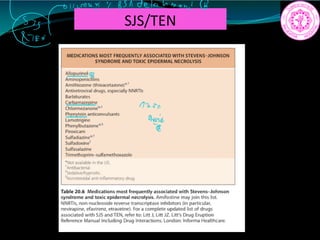 SJS/TEN
p
Bsadetachment
72T
Wet
 