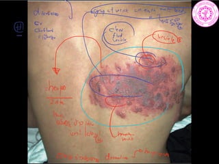 dissubero grpefvecillsinenthemct.tt
bare
Z.sk
solution
na
unilatedy
disobey dermatome thepaz.se
 