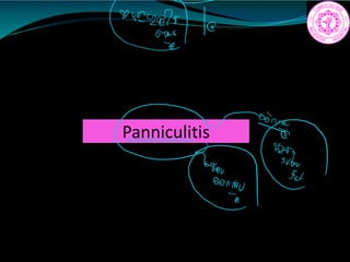 Panniculitis
8422211yd
 