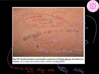 PI
i
in i t.ph
Prime lesinaviarpa
put them
2 a
igli string ones
6
assist
 