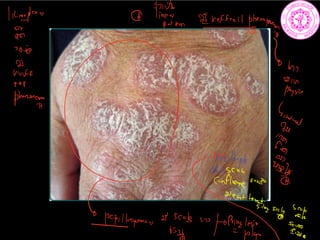 5718
linerpline
linfftemafreffrettpyenitmn.gg
2050
1
2
In
buff
rell
2 in
physics
show
8
s
wenthemstines.ba
E
pillagumcywsiale
tople
 