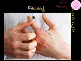 Diagnosis ? appud9411
E
8
9
 