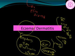 Eczema/ Dermatitis
251
102492
2
epidemig
inegead
 