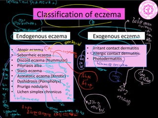 Classification of eczema
Endogenous eczema Exogenous eczema
• Atopic eczema
• Seborrheic eczema
• Discoid eczema (Nummular)
• Pityriasis alba
• Stasis eczema
• Asteatotic eczema (Xerotic)
• Dyshidrosis (Pompholyx)
• Prurigo nodularis
• Lichen simplex chronicus
• Irritant contact dermatitis
• Allergic contact dermatitis
• Photodermatitis
mm mm
i C
an
ii
tii l
figy
g
i
fgfgg.MIL
ii
Ji
 