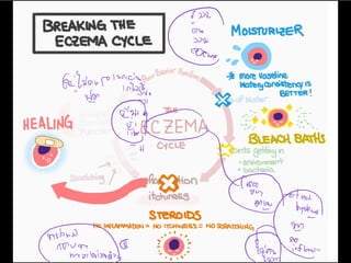 c
Giline c
we
iC
n
iii
iin
 