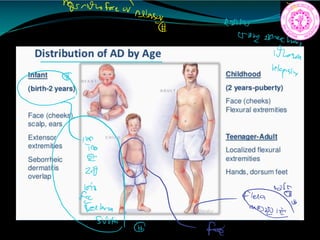 mm
any am
only sanctuary
1ham
relapsing
2
i i
face
 