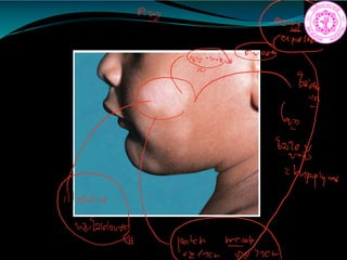 A
22
i
be
EE
ill idefird
wNW
 