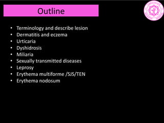 Outline
• Terminology and describe lesion
• Dermatitis and eczema
• Urticaria
• Dyshidrosis
• Miliaria
• Sexually transmitted diseases
• Leprosy
• Erythema multiforme /SJS/TEN
• Erythema nodosum
 