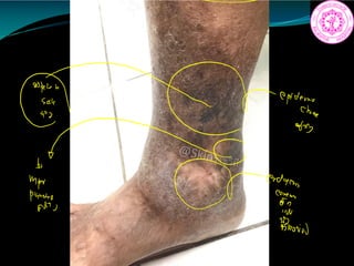 f epidemo
Change
My
titi EE
Blood
 