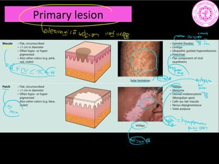 Primary lesion
blesimainan Into e
eiE
banence bqee. m
pn
i
ga
hterfEii. l.int
 