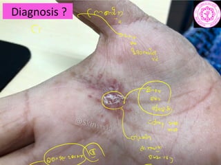 Diagnosis ?
tw
C
2
Loonwig
c
coari
amin
ani r
 