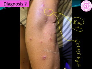 Diagnosis ?
af
110
27
et
 