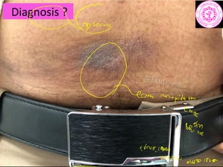 Diagnosis ?
Qem
main
Chary
4Th
VV10 950
0177144
held 15200
 
