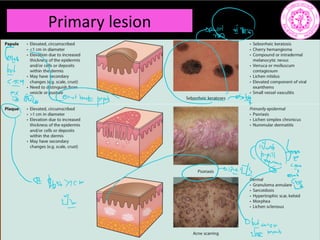 Primary lesion
62s
but
ahemtr.net
roseby
I
2
mar ii t.is
077m
V1
4
 