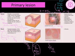 Primary lesion
f pub
www.msaswomtt. c
Gone
006.000
19thtobutafzuiydip.pe Come
90
Me
6ⁿ
no
6
WE
 