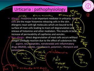 Urticaria : pathophysiology
• Allergic : histamine is an important mediator in urticaria. Mast
cells are the major histamine releasing cells in the skin.
Allergens react with IgE molecules which are bound to the
surface of mast cells leading to mast cell degranulation and
release of histamine and other mediators. This results in local
increase of permeability of capillaries and venules.
• Non allergic : direct degranulation of mast cells occurs without
antigen antibody reaction due to the effect of substances like
- aspirin, neuropeptides, nonsteroidal anti-inflammatory
drugs (NSAID), opiates, ciprofloxacin, polymixin, rifampicin and
vancomycin
we Unreamestrellor histamine
4128841022
Tomiskell
Efs
Gouldroscions
has
i.ie
i
i
10220
trainman mistreat
2 pathing
 