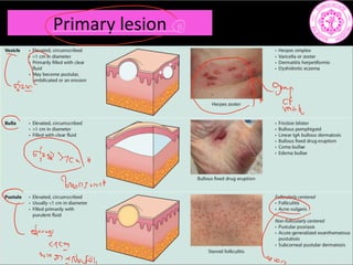 Primary lesion
c
TE distant
C
pDS
breeniven d
c
Coins
LACI
W
960
 