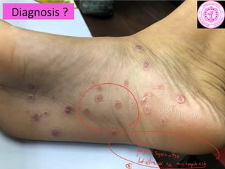 Diagnosis ?
a
Fii iEam
 