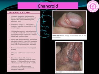 Chancroid
 