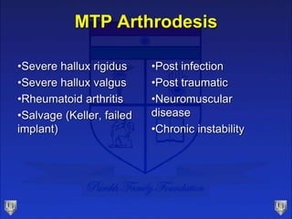 MTP Arthrodesis
•Severe hallux rigidus
•Severe hallux valgus
•Rheumatoid arthritis
•Salvage (Keller, failed
implant)
•Post...