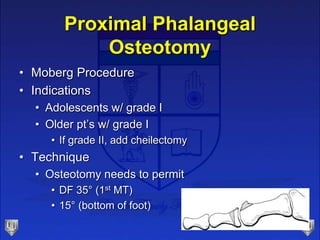 Proximal Phalangeal
Osteotomy
• Moberg Procedure
• Indications
• Adolescents w/ grade I
• Older pt’s w/ grade I
• If grade...