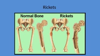 Lecture 4 Cartilage and osification.pptx