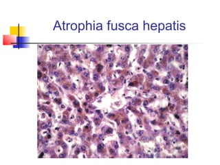 4 | PPT